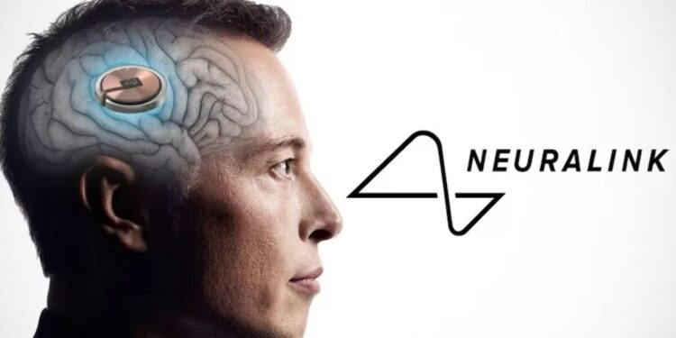 ¿te Atreverías Musk Busca Participante Para Ensayo De Chip Cerebral De